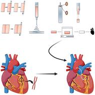 An overview of small diameter vascular grafts: from materials to fabrication