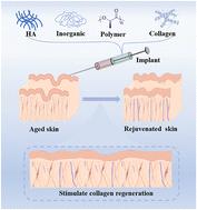 Recent progress of dermal implants for aged skin rejuvenation: a review