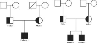 Molecular Characterization of Steroid 5 Alpha-Reductase 2 (SRD5A2) Gene Variant in Indian Patients with Disorder of Sexual Development