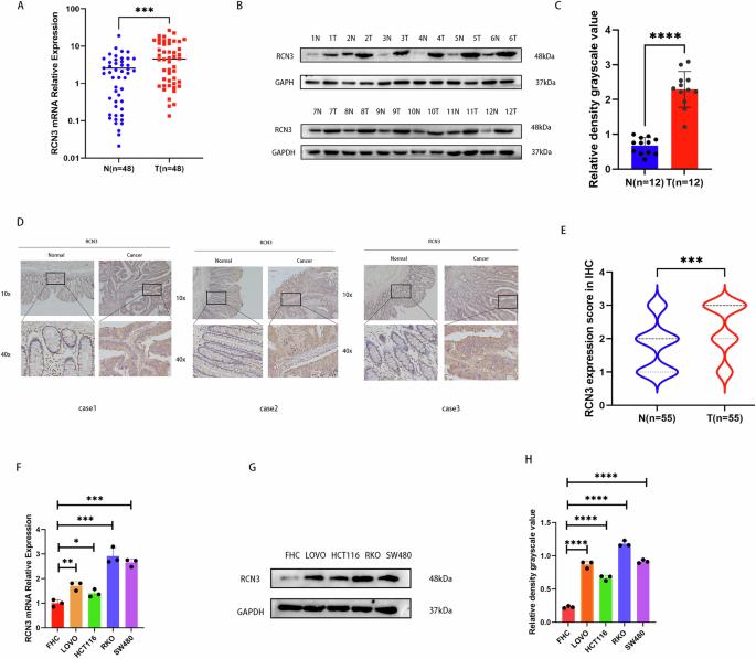 RCN3 functions as a tumor promoter in colorectal cancer by modulating the GRP78-PI3K-AKT signaling pathway