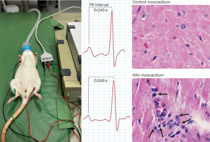 A transformative preclinical model of rheumatic heart disease