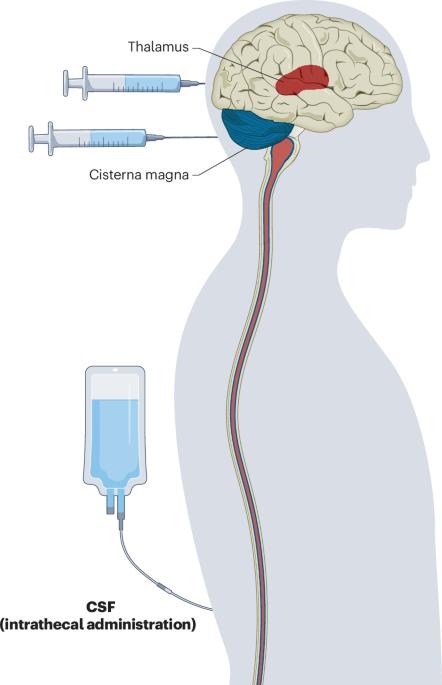 Location matters for brain gene therapy in lysosomal disorders