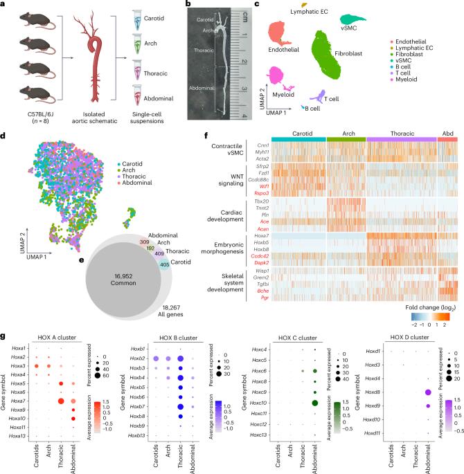 Region-specific gene expression and sex inform about disease susceptibility in the aorta