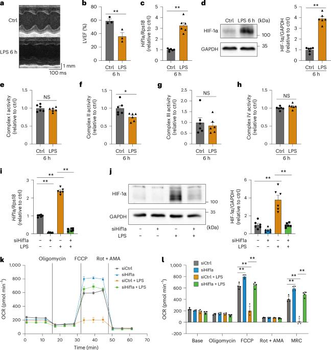 Excessive HIF-1α driven by phospholipid metabolism causes septic cardiomyopathy through cytopathic hypoxia