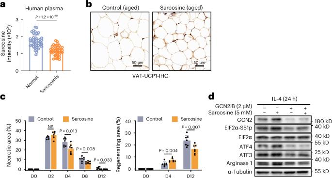 Sarcosine shows promise in preventing sarcopenia