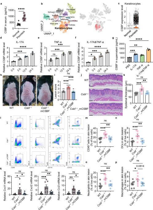 The cytokine CSBF inhibits the IL-17A and TNF-α inflammatory pathways via SUSD2-ACT1 in keratinocytes and alleviates IMQ-induced psoriasis