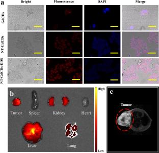 Nucleus delivery of doxorubicin by gadolinium-functionalized carbon dot drug delivery system for HCC imaging and therapy
