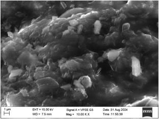 Development and Evaluation of 5-Flucytosine Solid Lipid Nanoparticle-Loaded Topical Gels for Enhanced Chronic Wound Healing