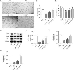 Coptisine alleviates high glucose-induced HUVEC dysfunction in vitro and inhibits gestational diabetes mellitus in vivo
