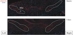 Partial Restoration of the Number of Dopaminergic Neurons in the Substantia Nigra in Mice with the Mptp Model of Parkinson’s Disease by Introducing a Microgel Based on Recombinant Spidroin rS1/9