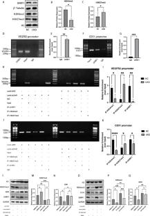 UHRF1 in endothelial cells is essential for angiogenesis and associated with the activation of pro-angiogenic signaling pathways and expression of endothelial genes