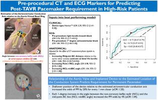 Preprocedural CT and ECG Markers for Predicting Post-TAVR Pacemaker Requirement in High-Risk Patients