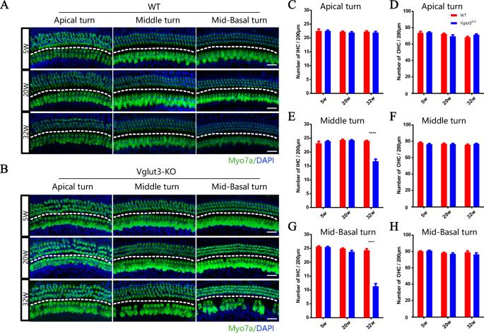 Gene therapy restores auditory function and rescues damaged inner hair cells in an aged Vglut3 knockout mouse model