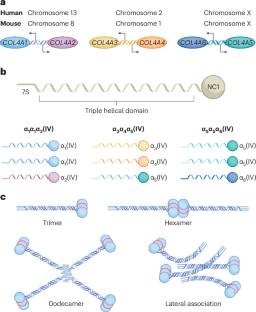 Collagen IV in Gould syndrome and Alport syndrome