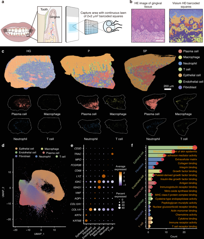 Single-cell spatial atlas of smoking-induced changes in human gingival tissues