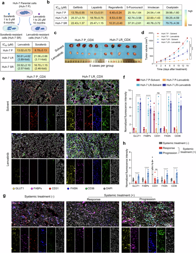 Targeting AKR1B1 inhibits metabolic reprogramming to reverse systemic therapy resistance in hepatocellular carcinoma