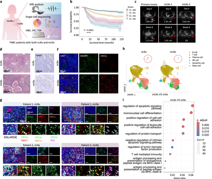 Chimeric exosomes-derived immunomodulator restoring lymph nodes microenvironment for sensitizing TNBC immunotherapy