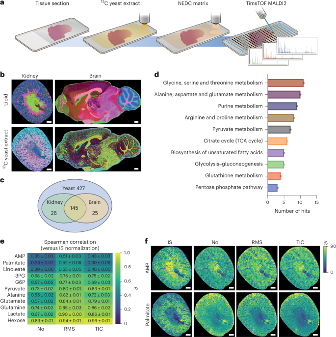 Spatial quantitative metabolomics enables identification of remote and sustained ipsilateral cortical metabolic reprogramming after stroke
