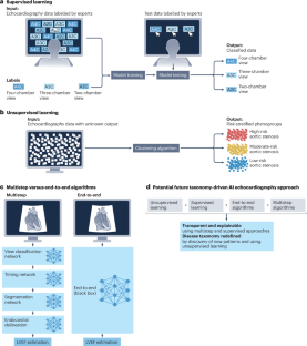 Artificial intelligence-enhanced echocardiography in cardiovascular disease management