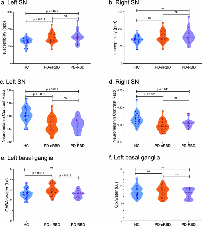 GABA outperforms iron and neuromelanin in detecting nigrostriatal alterations in early-stage Parkinson’s disease with RBD