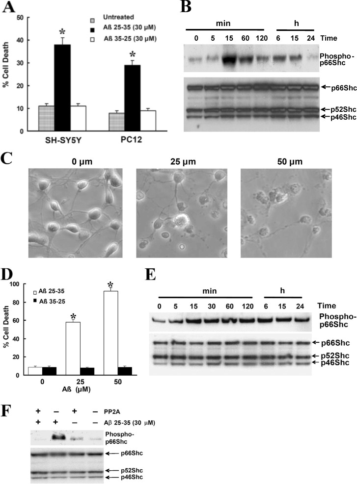 Correction: Phosphorylation of p66Shc and forkhead proteins mediates Aβ toxicity.