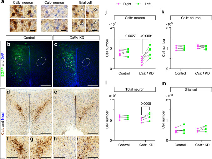 Emergence of the sex difference in calbindin D-28K neurons and the role of calbindin D-28K in clustering neurons of the preoptic area in mice.