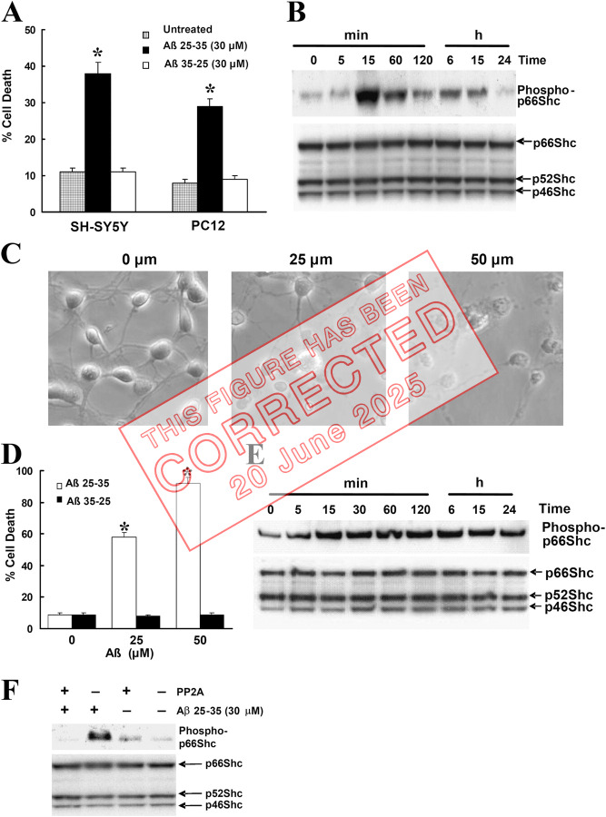 Correction: Phosphorylation of p66Shc and forkhead proteins mediates Aβ toxicity.