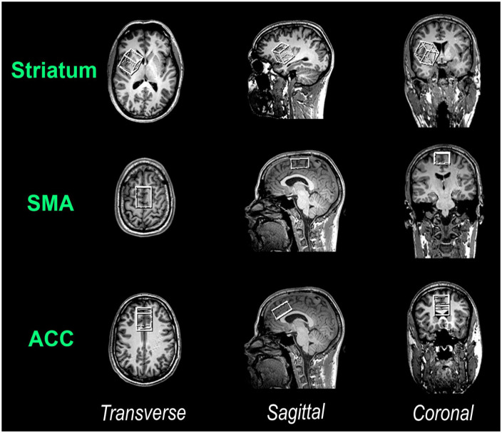 GABA and Glx levels in cortico-subcortical networks predict catecholaminergic effects on response inhibition.