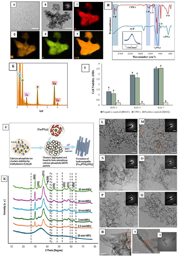 Potential of High-Intensity Focused Ultrasound in Enamel Remineralization.