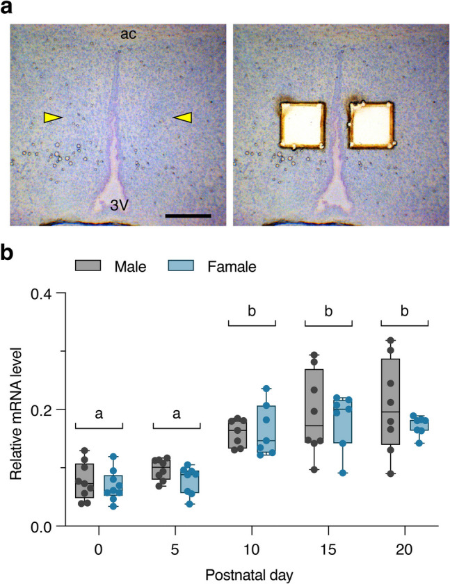Emergence of the sex difference in calbindin D-28K neurons and the role of calbindin D-28K in clustering neurons of the preoptic area in mice.