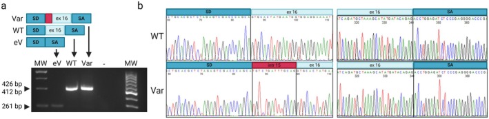 Functional Characterization of a Novel Intronic Variant in PIEZO2 in a Recessive Form of Distal Arthrogryposis With Impaired Proprioception and Touch (DAIPT).