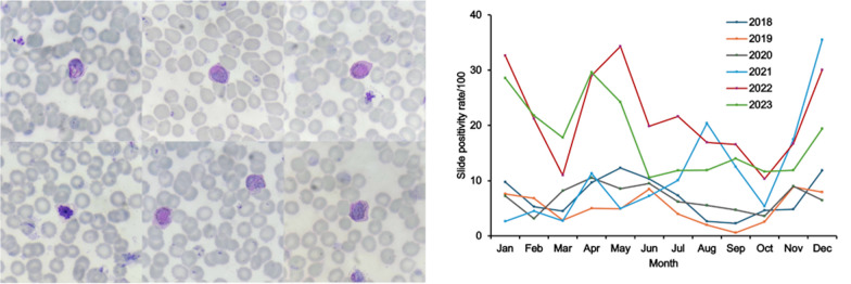 Slide positivity, trends, and risk factors of febrile Plasmodium vivax malaria along the Thailand-Myanmar border, 2018-2023.