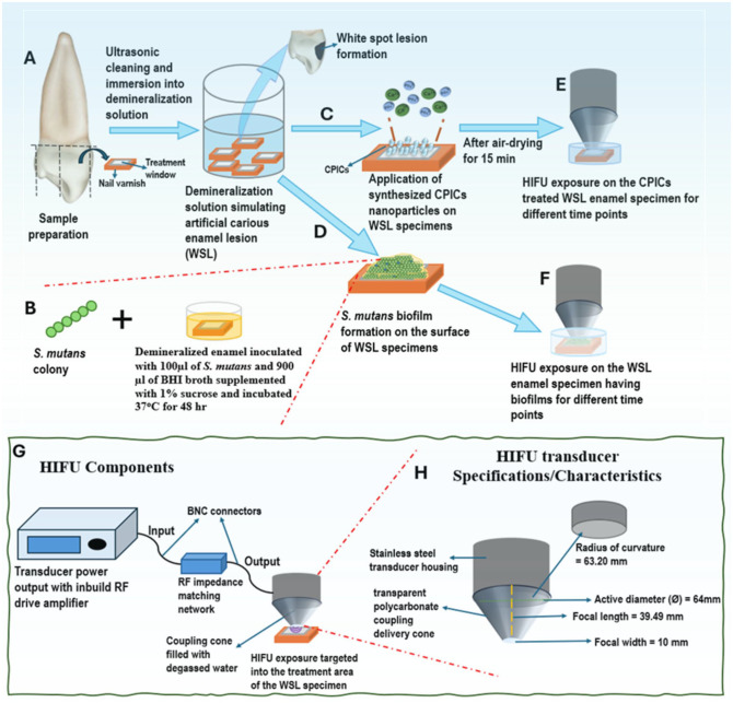Potential of High-Intensity Focused Ultrasound in Enamel Remineralization.