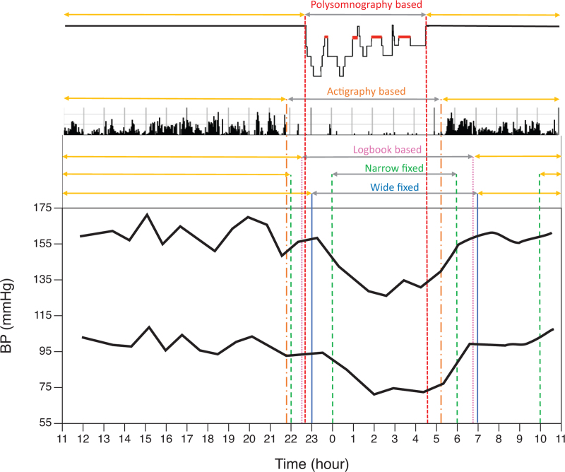 Nocturnal blood pressure: pathophysiology, measurement and clinical implications. Position paper of the European Society of Hypertension.