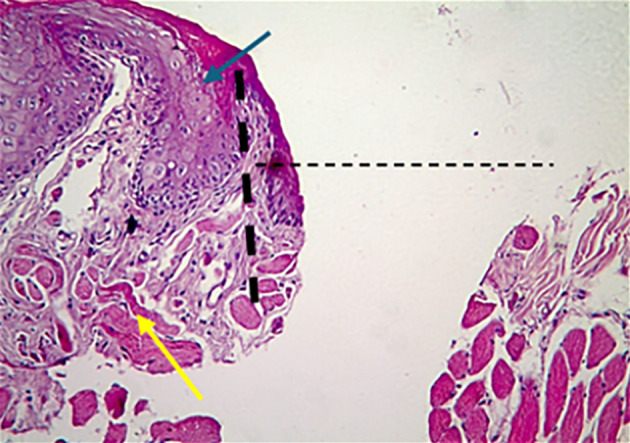 The Efficacy of Rosehip Oil Emulsion as a Pro-Healing Herbal Medicine for the Treatment of Induced Mucosal Ulcer (Cell Culture and Experimental Study).