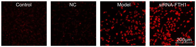 [Corrigendum] miR‑335 promotes ferroptosis by targeting ferritin heavy chain 1 in in vivo and in vitro models of Parkinson's disease.
