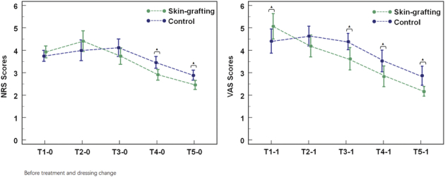 Efficacy of Stamp Skin Grafting to Promote the Healing Process of Chronic Wounds.