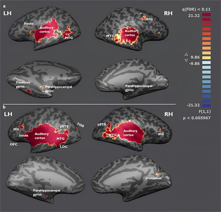 Decoding semantic sound categories in early visual cortex.