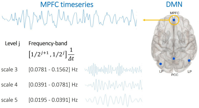 Toward a fair, gender-debiased classifier for the diagnosis of attention deficit/hyperactivity disorder- a Machine-Learning based classification study.