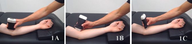 Diagnostic Musculoskeletal Ultrasound in the Evaluation of the Brachialis.