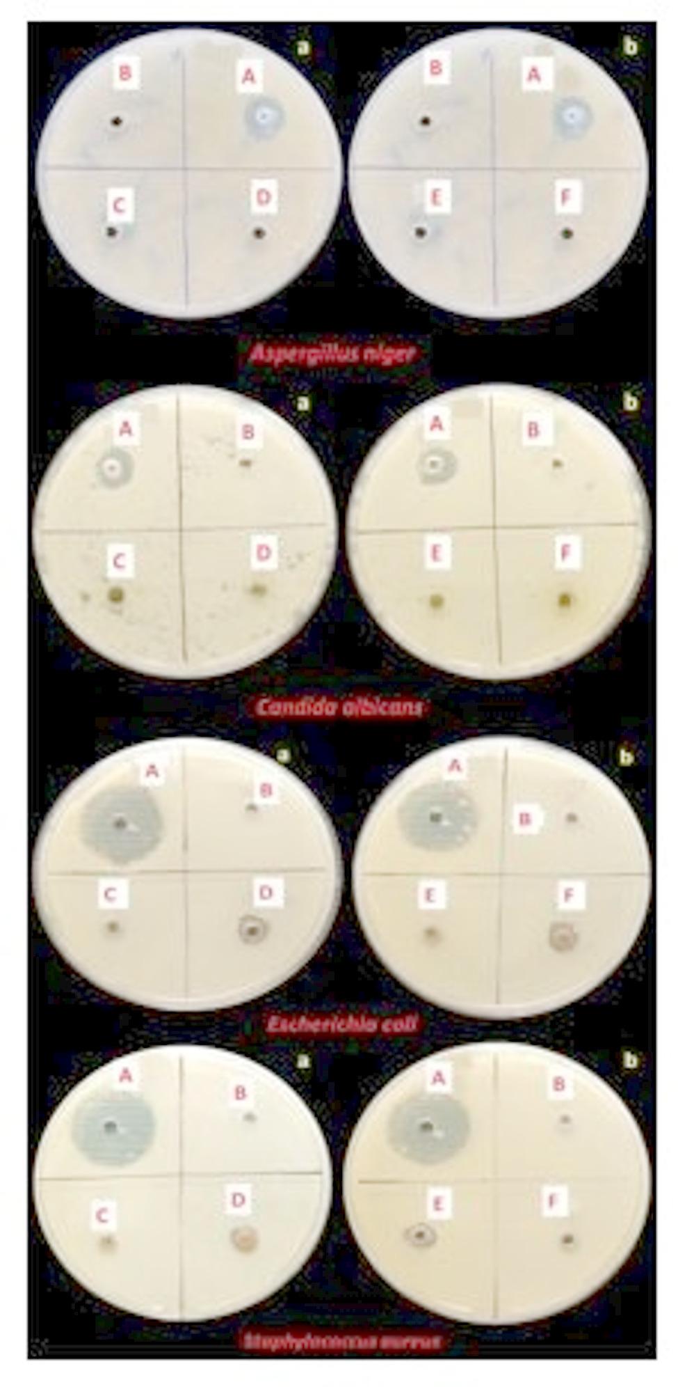 Is sacred animal (Asian Elephant) can be a medicinal repository: a new approach for colon cancer treatment using the methanolic extracts of the dung samples and their valuation for antimicrobial, cytotoxic, and apoptotic actions.