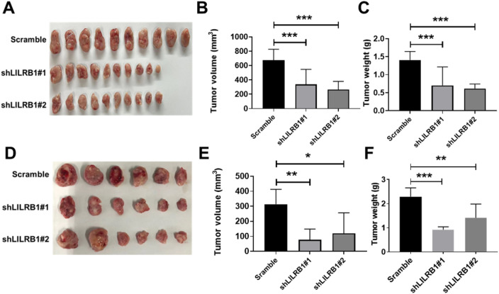 LILRB1 enhances the progression of diffuse large B-cell lymphoma through the CREB-SORBS3 pathway.