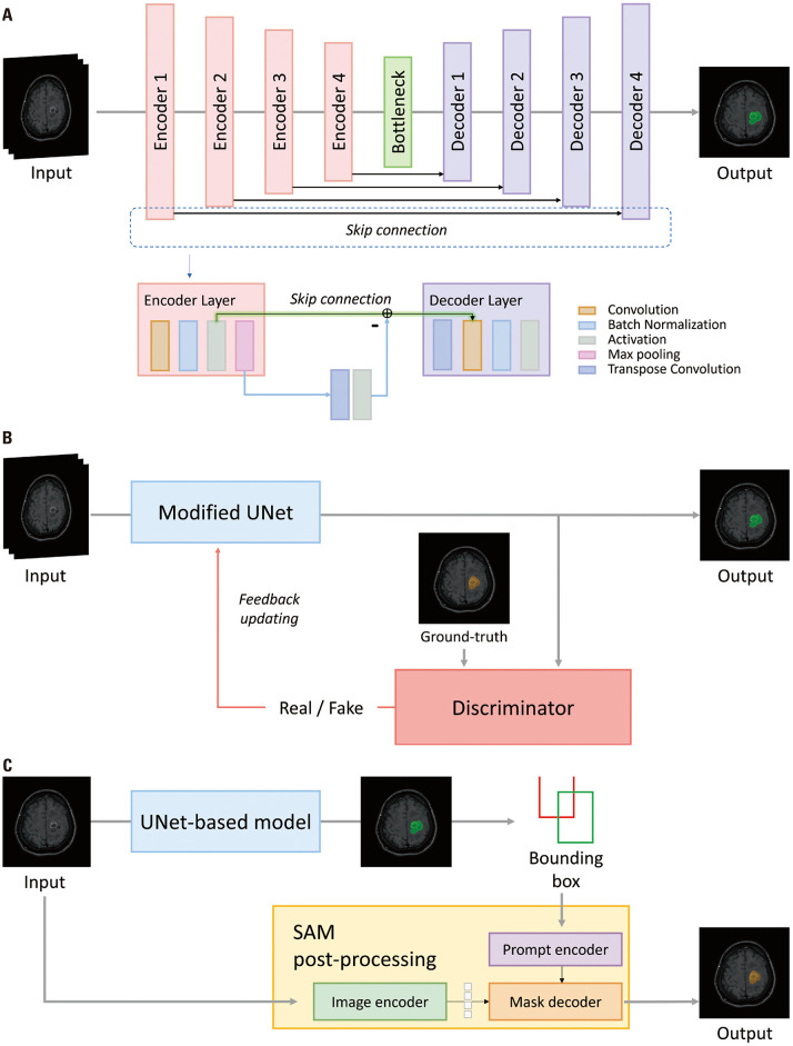 Enhancing Brain Metastases Detection and Segmentation in Black-Blood MRI Using Deep Learning and Segment Anything Model (SAM).