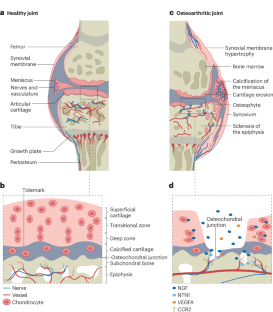 Peripheral neuronal sensitization and neurovascular remodelling in osteoarthritis pain