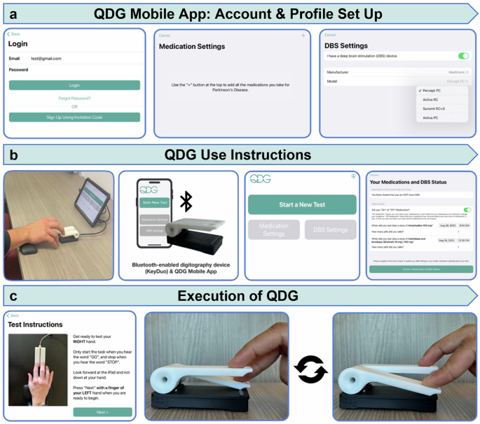 Remote real time digital monitoring fills a critical gap in the management of Parkinson’s disease