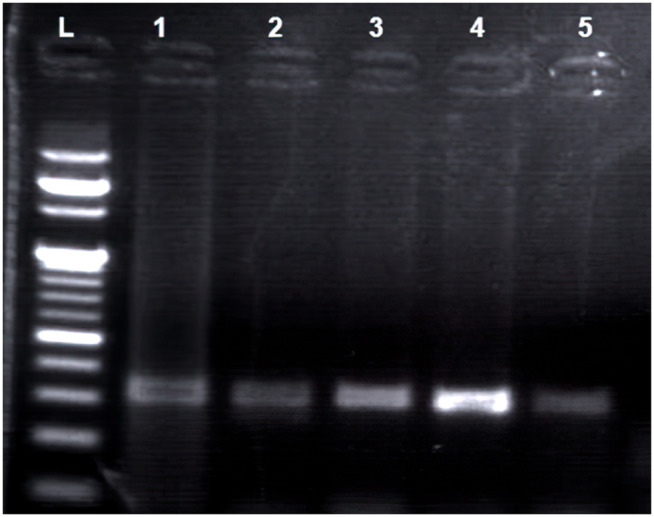 Association of FGF Receptor-2rs2981578 SNP with breast cancer in women at the University of Gondar Comprehensive Specialized Hospital, Ethiopia.