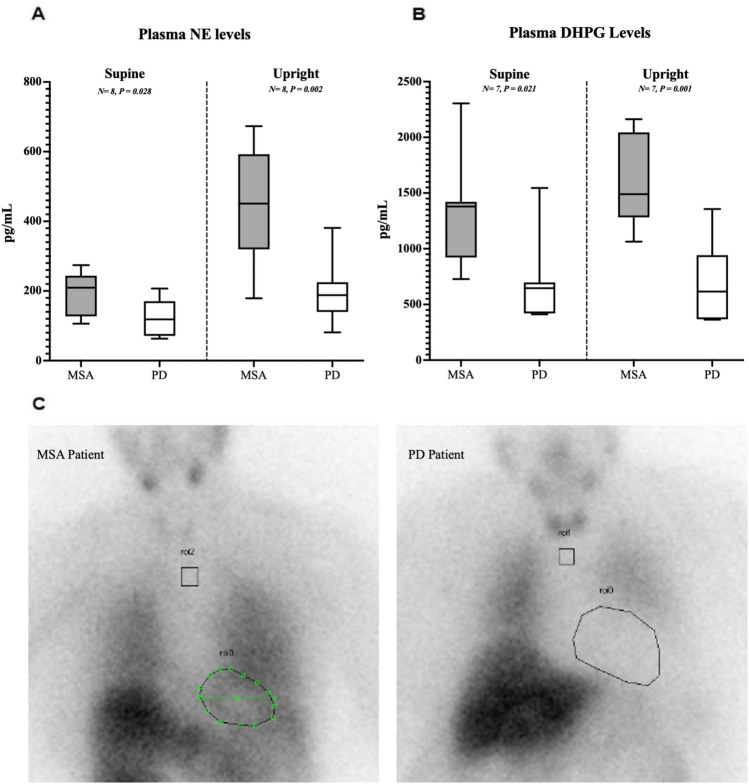 Peripheral autonomic failure is associated with more severe postprandial hypotension compared to central autonomic failure.