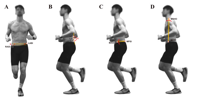 How Downhill and Uphill Running Interfere Posture and Muscle Activity: A Descriptive Laboratory Study.