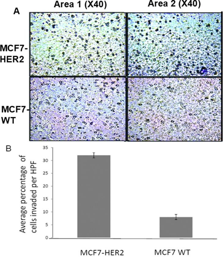 [Corrigendum] STAT3 activation in HER2‑overexpressing breast cancer promotes epithelial‑mesenchymal transition and cancer stem cell traits.