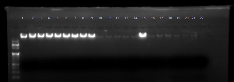 Association of FGF Receptor-2rs2981578 SNP with breast cancer in women at the University of Gondar Comprehensive Specialized Hospital, Ethiopia.